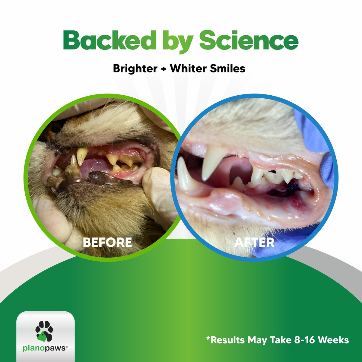 Dental Powder for Teeth Cleaning K3018