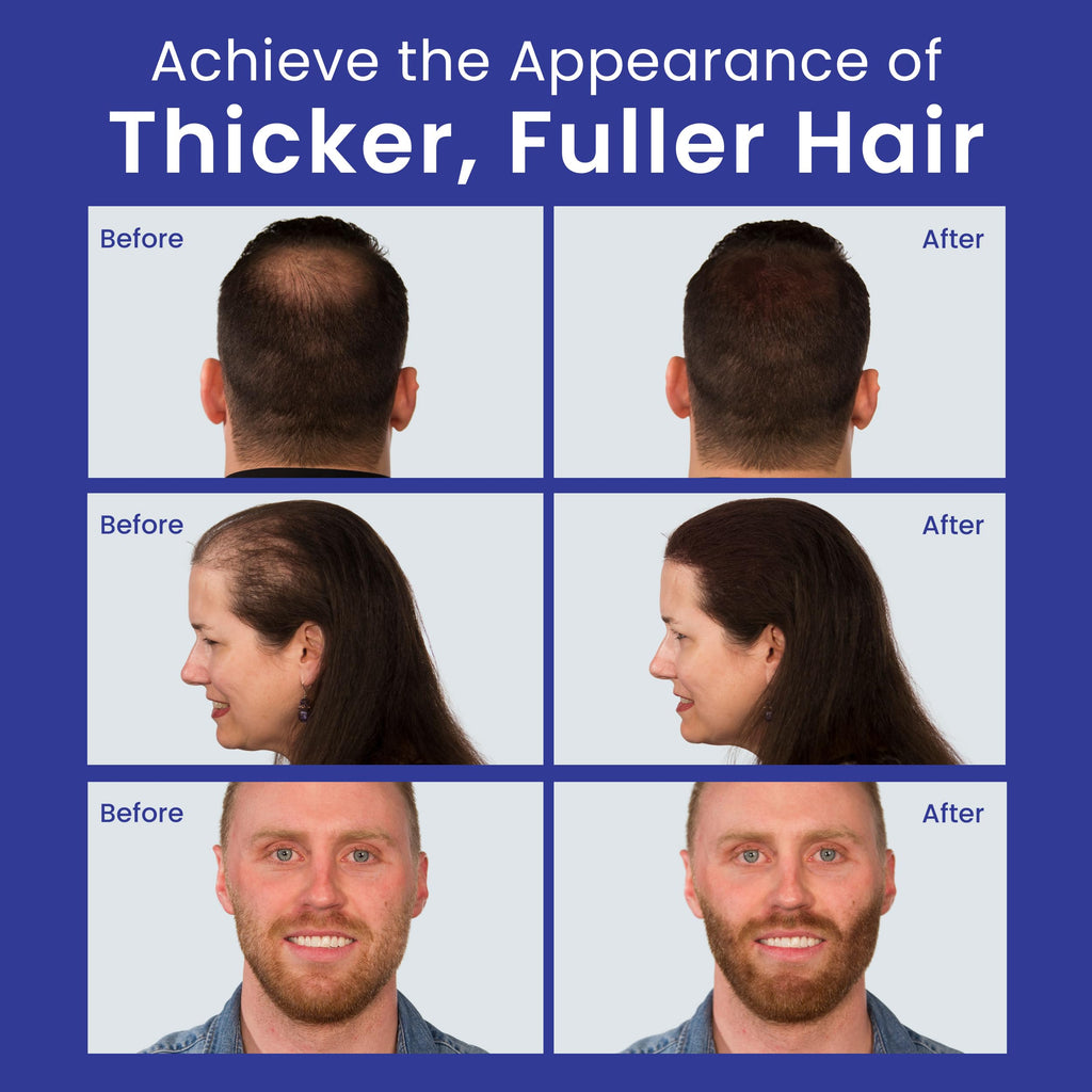 White Hair Fiber Powder 30g P842169